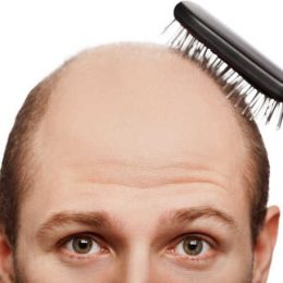 Gender and hair loss